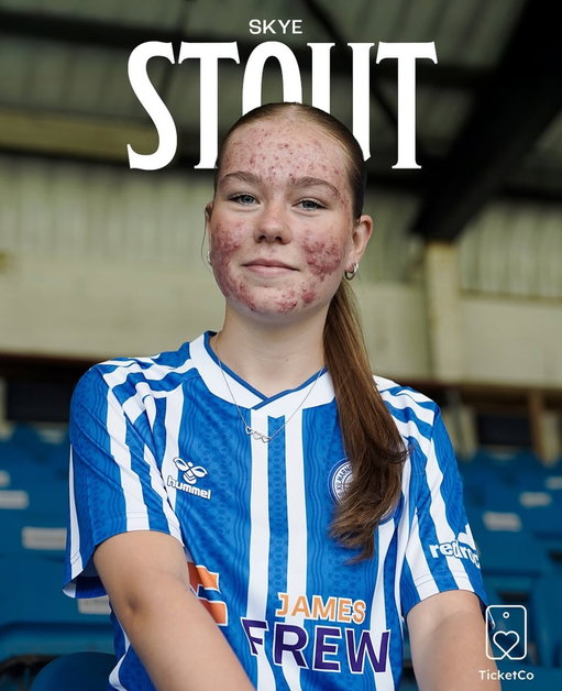 16-year-old Skye Stout got her pro signing with @kilmarnockladiesfc overshadowed by online bullying from a bunch of men’s soccer fans and the post was taken down. Let’s give her a proper redo and show her just how positive, supportive and incredible the women’s football space really is ♥️ Congratulations on signing your first professional contract Skye! We can’t wait to see where this journey takes you!!