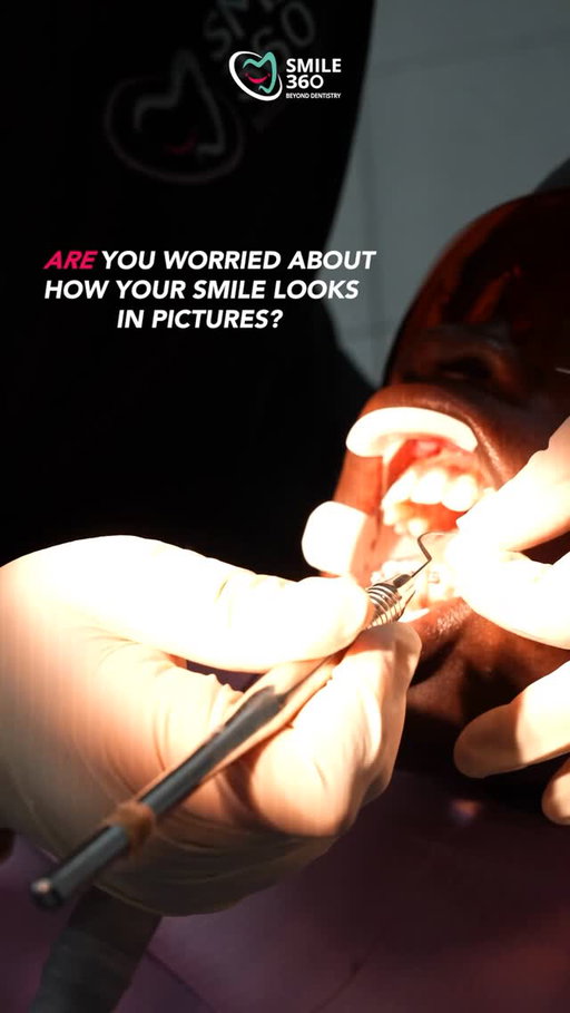 Let’s Make Braces Cool Again! 

They don’t just make your smile straighter, they also:

👉 Help you bite into apples and sandwiches with ease 🍎🥪
👉 Keep food from hiding between teeth (bye-bye cavities 👋)
👉 Protect your teeth from chips and injuries.

Come get yours on the 27th August, 2025 at Smile360 Clinic, Ikoyi, Lagos.

Got questions about braces? Big or small, we’d love to help. SMILE360 is where healthy smiles start! 💚