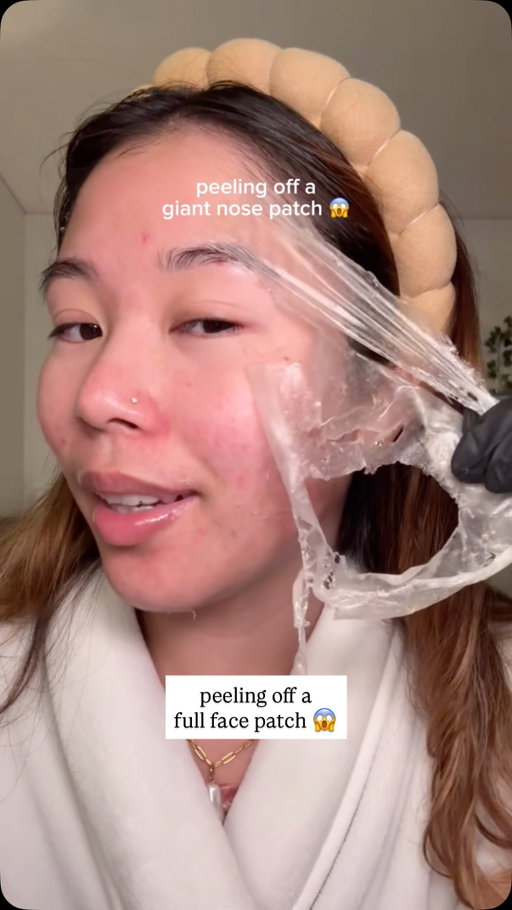 full face & body peel off mask 🤭 
--
products used:
@aprilskin_global real calendula peel off mask & carrotene ipmp clearing solution
--
#koreanskincare #skincare #acne #acneskincare #kbeauty #APRILSKIN #APRILSKINskincare #oddlysatisfying  #exfoliate #blackhead #pimplepatch #drmelaxin #koreanskincare