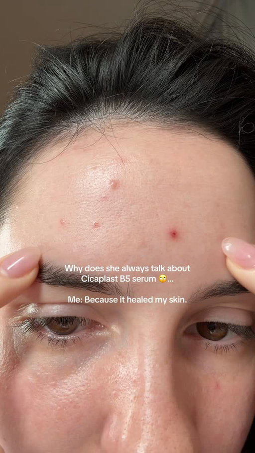 Damaged skin barrier, Redness, Breakouts - this is the best serum 👏🏻

Cicaplast B5 Serum 🫶🏻
