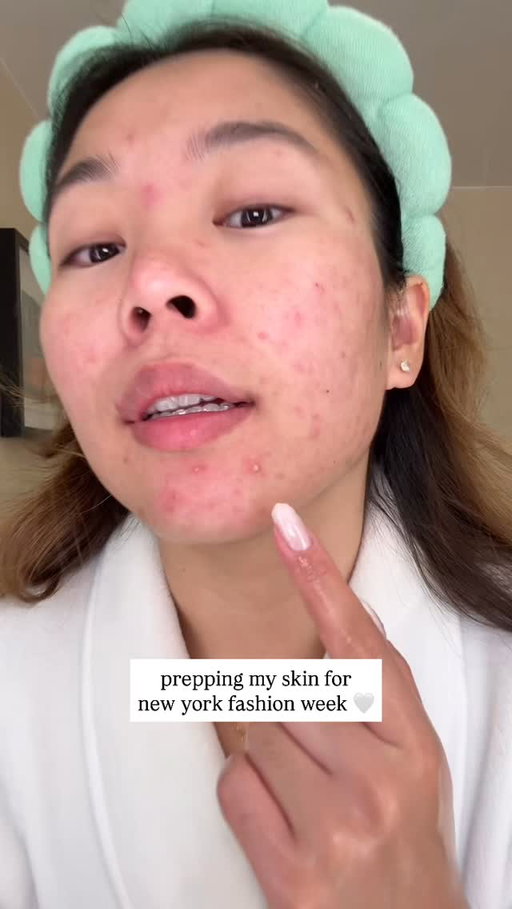 of course my skin is breaking out rn 😭 
--
#acne #acneproneskin #skincare #acneskincare #pimplepatch #pimplepatchpeel 
--
@easyderm.official @purito_official @caudalie @neutrogena @tower28beauty