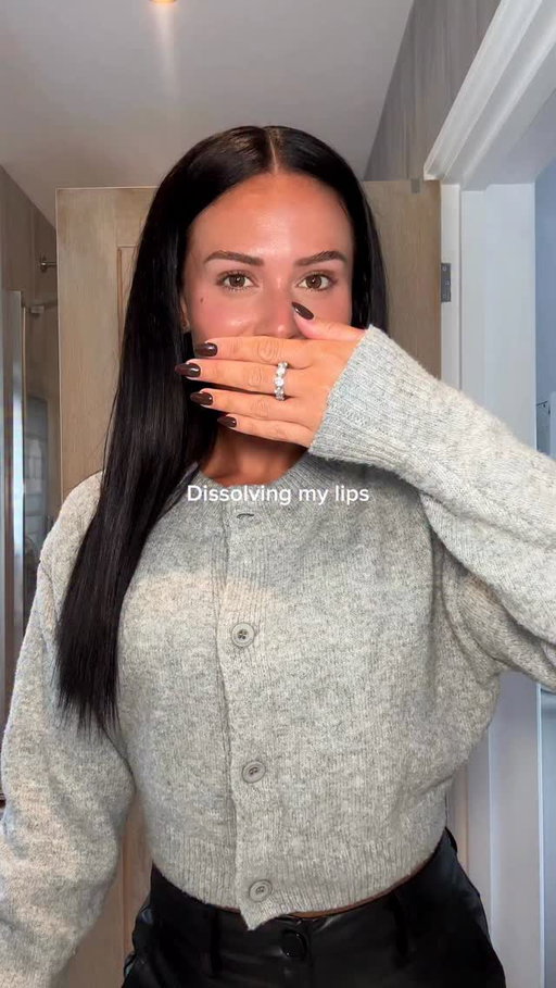 I’ve been so nervous to show you all 🥹
Thank you @grand_aesthetics_clinic @drsoniasoopen for making me feel at ease! 

It’s been such a long time since I’ve seen my natural lips but I actually love them 🤍🤍