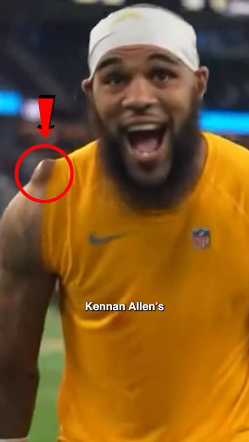 How does this not hurt 🤢

#nflfootball #losangeleschargers #nflnews #sportsscience
