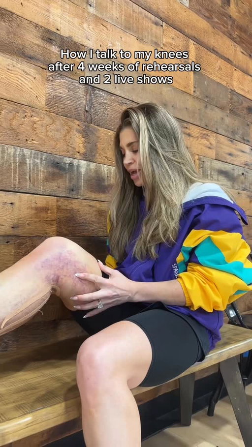 I promise my leg feels better than it looks 😂 @dancingwiththestars