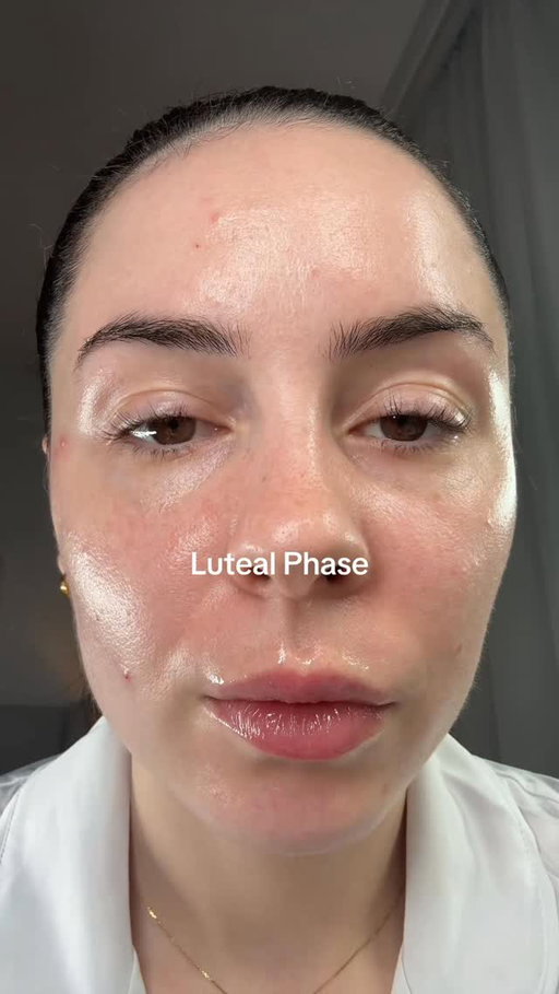 Luteal Phase Vs menstruation Vs Follicular Phase Vs Ovulation. 

I found myself having a few more spots than normal in my ovulation phase! I love seeing the differences on how our hormones play a massive role in our skin!