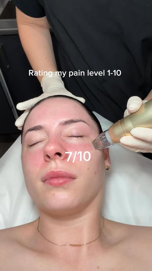 Rating my pain level from 1-10!

She was 🥵