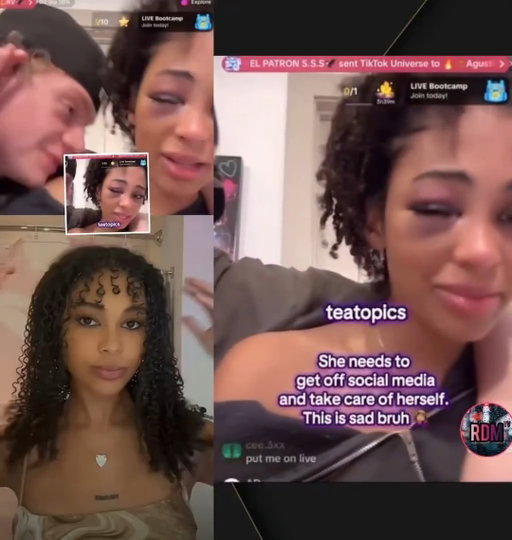 SMFHHH 

Woman was punched and assaulted by her boyfriend, she claims he still loves her and insists they’re “good” after they both went live on social media to address it