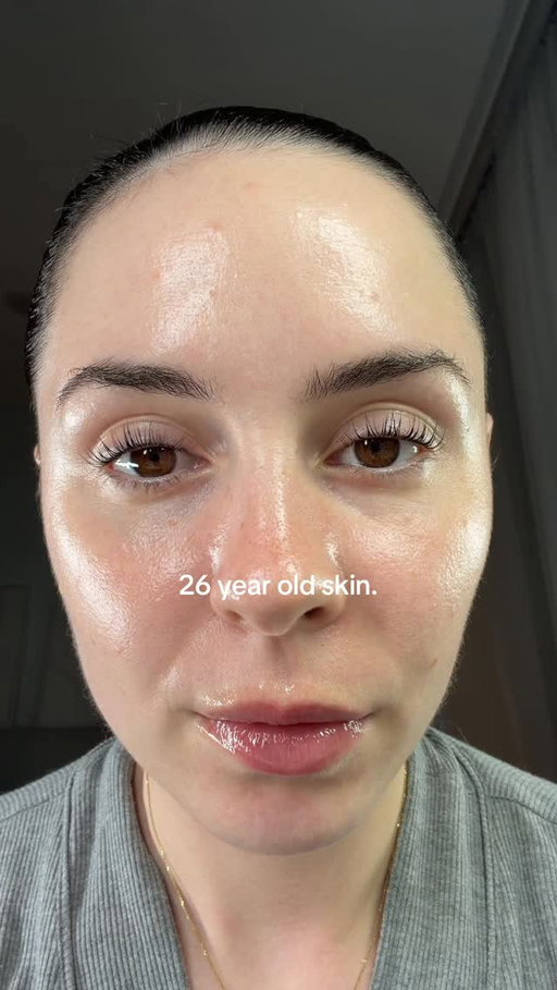 26 year old skin. No filter, Up close & personal

Definitely been seeing a lot of unnecessary hate online toward women and their skin journeys lately. Having the confidence to show real skin, no filters, all stages is beautiful. Remember, skin is a living organ, it’s always changing. Let’s be kinder.