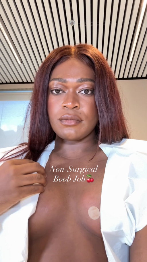The results are in for my 2nd session with @cleavageclinic non surgical boob job 🍒 & i literally couldn’t be happier!!