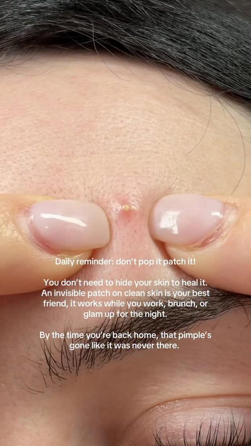 Effaclar Duo+M 3H Spot Patches by @larocheposayaunz clinically proven to deliver visible results from just 3 hours. Fast, effective, and invisible so you can treat breakouts confidently, anytime, anywhere. 💙 #Effaclar

*Consumer test, 54 subjects after one application *Cosmeto-clinical study, 64 subjects, presenting with 108 spots, 3 hrs after application AD