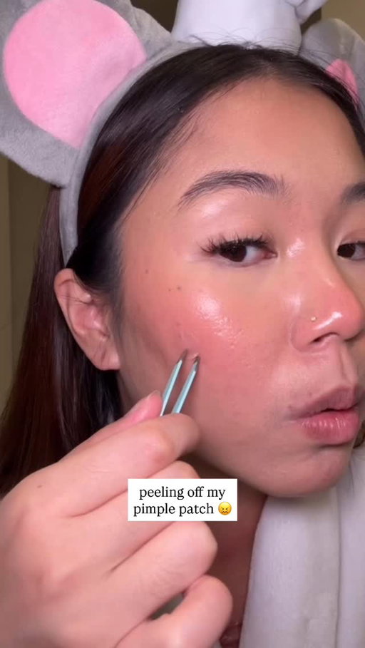 wow that peel was insane 😱
--
products used:
@peaceoutskincare acne day dots
@tower28beauty sos spray
--
#acne #skincare #pimplepatch #acneskincare #skincareroutine