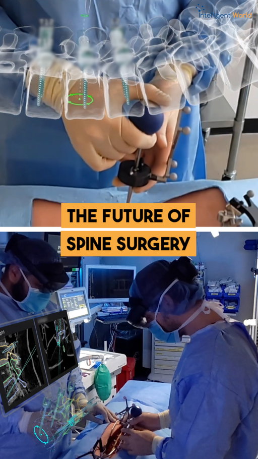 Would you trust a surgeon who could see inside your spine—in real time?”

That’s no longer a hypothetical. AI and augmented reality now allow surgeons to turn 2D scans into lifelike 3D holograms they can walk through before ever making a cut.

Every movement, every instrument, tracked to the millimeter. Holographic overlays guide the safest path—reducing risks and transforming outcomes.

The implications go beyond healthcare. This is what happens when spatial computing meets mission-critical decision-making: visibility, precision, and performance at an entirely new level.

As enterprises push toward digital transformation, the lesson from medicine is clear—seeing differently leads to acting smarter.

Medivis’s FDA-cleared Spine Navigation platform is leading this new era of intelligent visualization—and redefining what’s possible when AI and AR work together.

Don't miss out on the latest AI advancements! Make sure to follow my channel!

#AI #AugmentedReality #3D #HealthTech #DigitalTransformation #Tech #Innovation