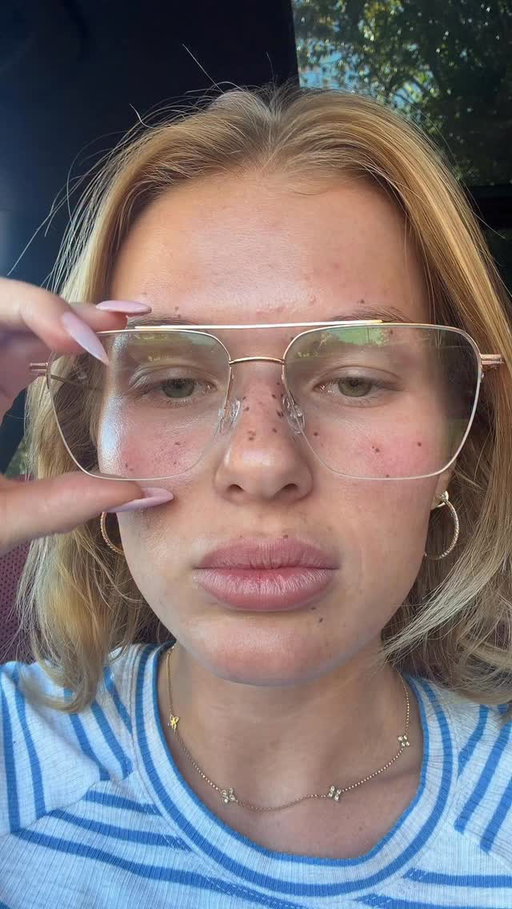 5.	den hojení mých tattoo freckles 🙂‍↔️ Miluju je! Chápu, že to spoustě lidem nedává smysl, a je to naprosto v pořádku 🫶🏻 Your body, your choice. 🤍
Pihy prý vydrží maximálně 8 měsíců. Mě ještě čeká korekce, ale jsem fakt maximálně spokojená!