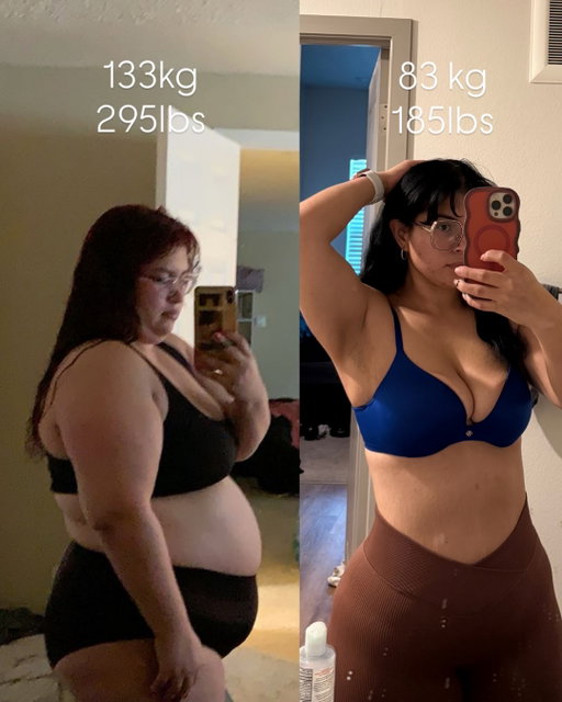 Don’t compare your journey to anyone else’s… because nobody is living the battles you’ve had to fight. Everyone has their own timeline, and mine has been anything but easy.

I was supposed to get my mommy makeover after losing 127 lbs a year and a half ago. I was ready… excited… hopeful. And then my health got in the way. My anemia got so bad that I had to put everything on hold and choose healing instead. It wasn’t what I wanted, but it was what I needed.

And I’ll be honest… lately it’s been hard. I look at my loose skin and sometimes I don’t see the woman who fought so hard — I just see everything I wish I could “fix.” Clothes don’t fit right, I get discouraged, and I forget to celebrate the version of me who crawled out of such a dark place to even get here.

But today… this is a reminder to myself:

I am strong.
I am powerful.
I am STILL becoming.

This skin? These insecurities? They don’t erase the fact that I’ve come farther than I ever imagined. They don’t erase the nights I cried, the mornings I pushed myself, the weight I carried — physically and emotionally — to get to this point.

One day, I will have the body I dream of. One day, I’ll finish what I started. And when that day comes, I’ll know I earned every bit of it.

But until then… I need to love myself harder. I need to give myself credit. I need to remember that healing, growing, and becoming the best version of myself doesn’t happen overnight.

If you’re on this journey too — please hear me:
You are not behind.
You are not failing.
You are becoming.

And that alone is something to be proud of. 💗

#explorepage #strong #weightloss #selflove #fit #fitness #healthy #health #bodytransformation #glowup #motivation #viral #fyp #weightlossjourney #healthjourney #healing #realandraw #127lbsdown #bodyrecomposition #bodydysmorphia