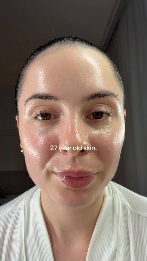 27 year old skin up close.