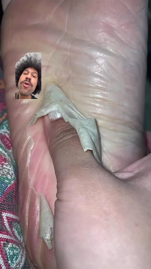 Peak satisfying, dead skin removal