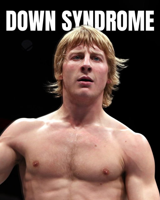Paddy Pimblett participated in a charity boxing fight with a boxer who has down syndrome. 

Wholesome.