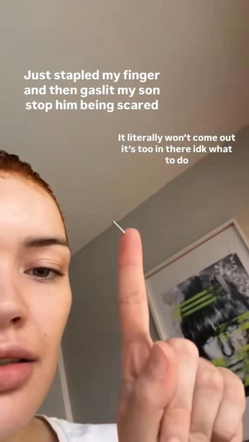 Happy 1 year anniversary of staple in my finger day #memories