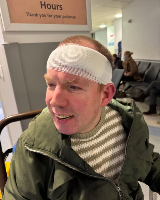 Lost Balance Guy strikes again!

This is your periodic reminder that living with a disability can be shit sometimes, however well your life is going.

I fell and split my head over the weekend and was left feeling silly and useless. But this isn’t a post for sympathy. It’s a post to say it’s ok to feel like that sometimes. If you’re disabled, you already know this part.

The disabled community is incredibly resilient. Not because we have to be heroic, but because we keep going. We don’t stay down. We pause, recover, and carry on. However that looks for you.

Huge thanks to the NHS staff at the RVI for putting me back together. And sorry to the people of Newcastle and Mexborough for missing the shows. I’ll make it up to you. 

#DisabledCreator
#DisabilityAwareness
#DisabilityLife
#StandUpComedian
#BritishComedy
#NHS