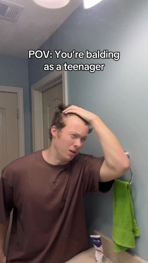 It’s bad @andreww_mckenna #balding #teenager #hairline #bald #relatable