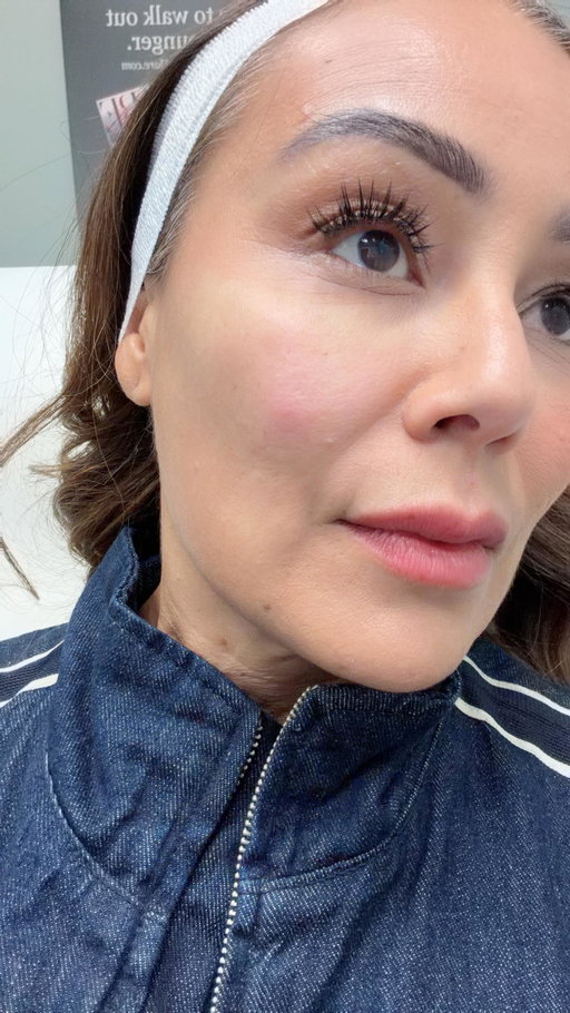 TMI post of the week... What to do when you work on television and you begin to develop a deep, painful massive pimple? You visit Dr. Lisa Kellett at @dlkonavenue, of course!