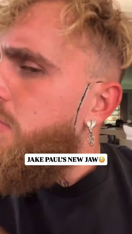 @jakepaul got a new jaw for his birthday?!?😳

What yall think??⬇️🤖

#jakepaul #boxing #jawbreak