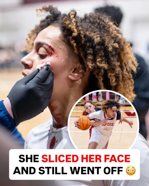 Peanut cut her face WIDE OPEN and still managed to go off against King’s Christian.

The Louisville commit is built DIFFERENT 😳