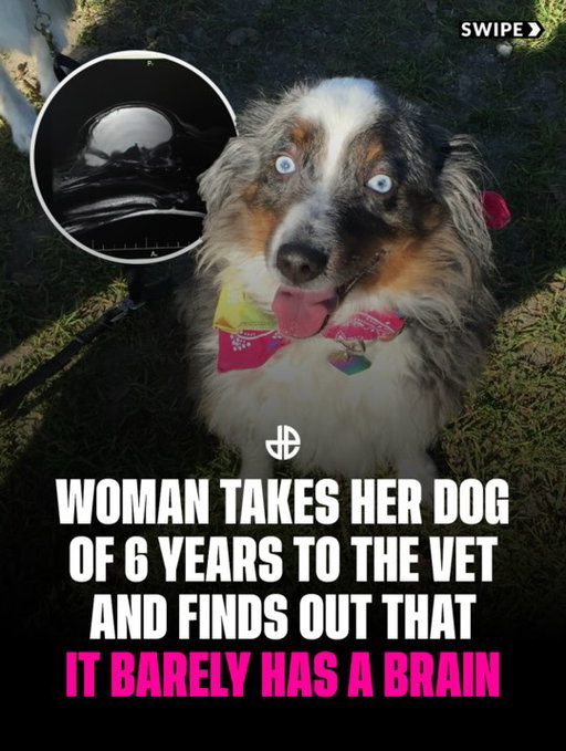 This dog lived almost her entire life with barely any brain and nobody knew. 😳

For six years she seemed mostly normal. She even had a litter of puppies. They always felt something was a little off, but nothing alarming until one day she had a seizure. At the vet, blood tests showed her sodium levels were dangerously low, so low they kept her overnight. She was sent to UC Davis, where specialists were shocked she could even walk based on her labs. After days of testing, an MRI revealed the truth: she had severe hydrocephalus, with around 95 percent of her brain cavity filled with fluid. Almost all the white in her scan was fluid, not brain tissue. Even more incredible, her low sodium was not random. Her body had adjusted itself to protect what little brain tissue she had left, creating its own version of balance just to survive. There was no surgery, no medication, just instructions to keep her well hydrated. She went on to live until she was 12 years old, until frequent seizures finally told them it was time to let her go.

RIP 🐶❤️

📸 Reddit User SnooHabits6942