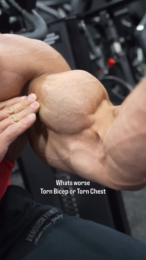 Worst muscle to tear!??

@hd.muscle @elev8.foods 
Code: Devin