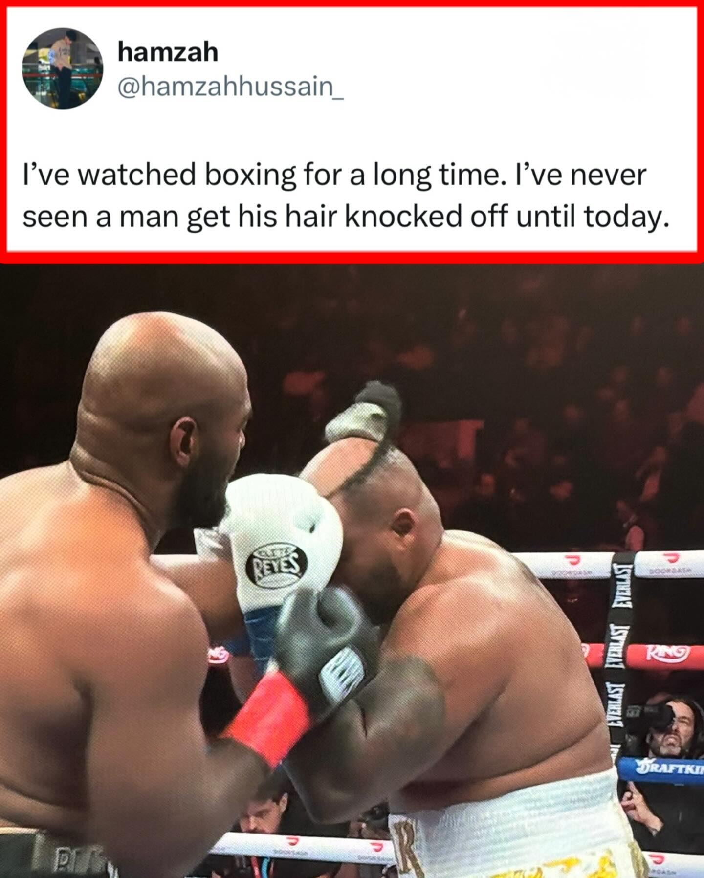 Jarrell Miller somehow got his HAIR knocked out 😭

(Via: Murfey6/X)

🎟️ Buy #RING6 | Teofimo Lopez vs Shakur Stevenson |LIVE NOW | Exclusively on DAZN | @ringmagazine