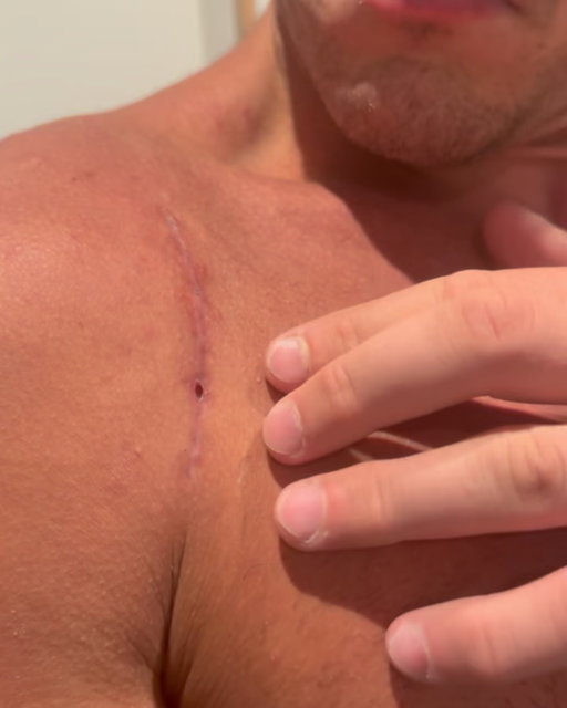 Depois de 17 meses, 4 cirurgias, quase 1 ano sem treinar Jiu-Jitsu e vários outros obstáculos no caminho, amanhã será anunciado o meu retorno.
Mesmo diante de tudo, eu sempre encontro uma forma de dobrar a aposta em mim mesmo, porque a única maneira de encarar a vida é mostrando para ela que estamos no comando.

Amanhã é sobre celebrar. Celebrar o corpo que resistiu, a mente que não cedeu e o privilégio de voltar aos tatames.

After 17 months, 4 surgeries, almost 1 year without training Jiu-Jitsu, and several other obstacles along the way, tomorrow my return will be announced.
Even in the face of everything, I always find a way to double down on myself, because the only way to face life is by showing it that we are in control.

Tomorrow is about celebration. Celebrating the body that overcame everything, the mind that never gave in, and the privilege of returning to the mats.