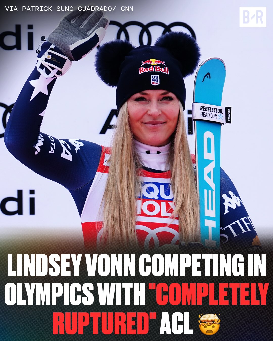 41-year-old American skiing superstar Lindsey Vonn “completely ruptured” her ACL ONE WEEK BEFORE THE OLYMPICS, per Patrick Sung Cuadrado 😳

Vonn still plans to compete in the 2026 Winter games... WOW 🤯