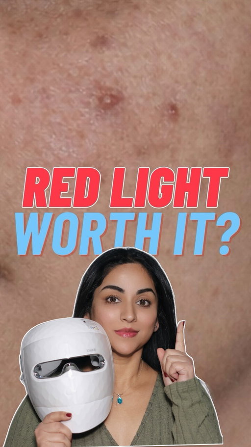 Here’s one of my most requested update after using the Ulike ReGlow LED mask consistently for over a year ✨
I’ve noticed clearer, calmer, more even-looking skin. Redness has gone down and my overall tone looks brighter.
It offers 4 light modes and full-face coverage, so treatments feel targeted and effective. I use it for about 10 minutes and it fits easily into my routine as a busy working mom
Comment “link” for the direct link in your DMs 💬
Use code smitha for $100 off and get an extra box of face masks ($120 value) 🎁
@ulikeglobal #ad #skincare #ulike #redlighttherapy #facemask