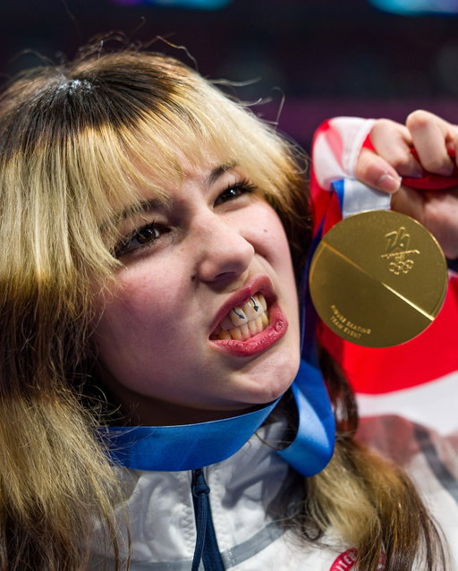 Alysa Liu deserves another gold medal for her hair 🥇