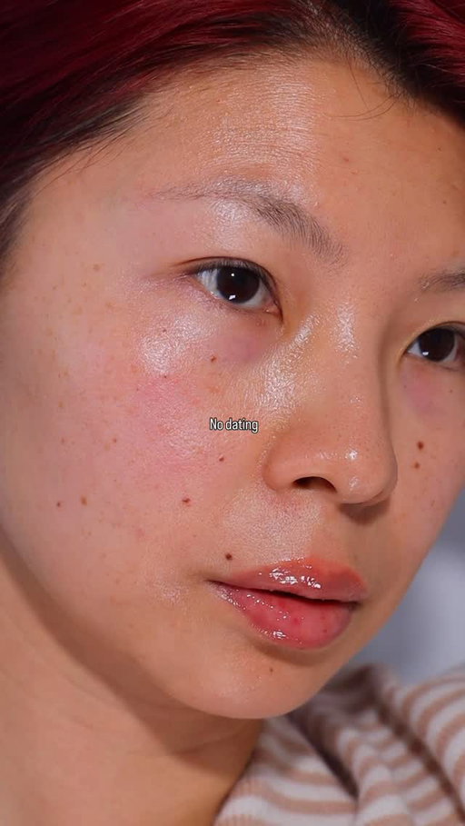 Peace first, @Lumarasystem VISO second. The red light mask of my dreams ✨What shows up first when something’s off?

This video is basically my skin revolution over the past seven years. 

Two years into a toxic relationship, my skin and mental health completely deteriorated. I developed bumps out of nowhere, experienced severe alopecia, and at one point genuinely thought I was depressed again. My body was trying to tell me something—I just wasn’t listening yet.

Then came 14 months of celibacy and not dating at all. My skin had never looked better. I was regulated. Calm. Clear.

Then I started dating again—100+ dates—and my skin reacted in the worst way possible. That’s when it really clicked: my body had been silently keeping score. The same red light mask I’d been using for the past three years just wasn’t doing it for me anymore. That’s when I knew I needed an upgrade.

I’ve been using red light therapy consistently for the past three years and genuinely swear by it.
2026 is the year to upgrade your red light mask and choose one with better coverage. 

PR gifted -afflicted code Tesschung for $$$ off