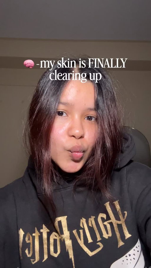 How am I 22 and still figuring out acne😭