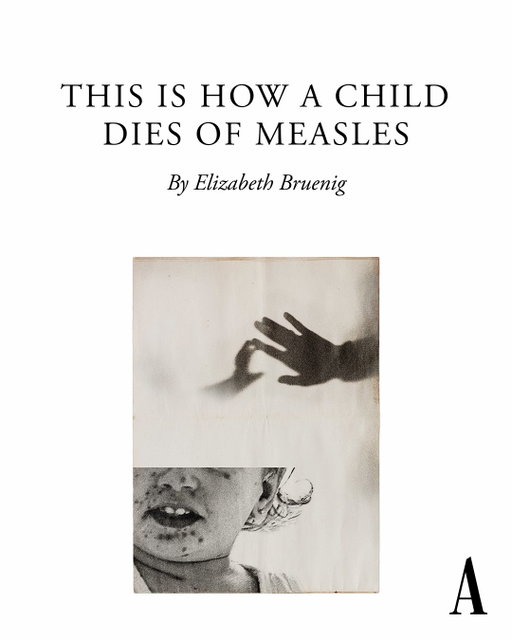 You’ve taken your daughter to a birthday party. In the air, invisible, is the measles virus. Even if she survives, the virus may never be done with her, or the other people it has infected. Elizabeth Bruenig on what measles can do to a body, to a brain, and to a family:

The virus might be transmitted “from an infected but asymptomatic child who was hopping and laughing among the others,” Bruenig writes. “The infected aerosolized droplets will linger in the air for hours, which is partly why measles is among the most contagious diseases in the world.”

“The virus infects roughly 90 percent of unvaccinated people exposed to it; the infected can then, in turn, infect a dozen to several hundred people each,” Bruenig writes. “Among the unvaccinated, one in five people infected with measles in the United States will require hospitalization, and roughly two out of every 1,000 infected children will die of complications, regardless of medical care.”

After two weeks of steadily worsening symptoms, your daughter and infant son are diagnosed with measles. “Your daughter is in pain and bewildered and afraid, but you tell her everything is okay,” Bruenig writes. “You try to keep your voice even, though your heart is pounding.”

“Most children infected with measles will survive the virus, but 30 percent of cases lead to complications, and it is nearly impossible to predict which patients will be affected,” Bruenig continues. Your son “lost some of his hearing, but the doctors say that he could make a full recovery in a matter of months.”

Eight years later, your son begins acting uncharacteristically. He is diagnosed with a rare measles complication that leads to irreversible degeneration of the brain. “There are treatments but no cure,” Bruenig writes. “Your son will continue to lose brain function as time passes, resulting in seizures, severe dementia, and, in a matter of two or three years, death.”

“You look at your son, the glasses you picked out with him, the haircut he chose from the wall at the barbershop, the beating heart you gave him,” Bruenig continues. “You know that you, too, will never recover.”

Read more at the link in our bio.

🎨: The Atlantic