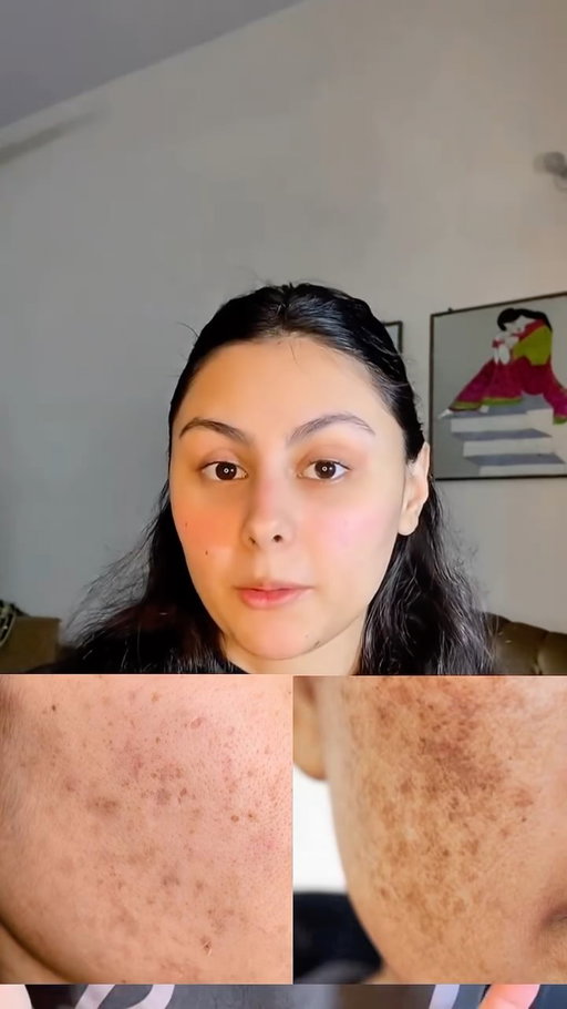 Say goodbye to dark spots and hello to even, glowing skin ✨
Our Pigment Corrector Serum works deep to fade pigmentation and brighten your complexion.
Lightweight, powerful, and made for everyday glow.
Consistency is the secret to spotless confidence 💛
.
.
#oneskin #pigmentation #pigmentcorrectorserum #skincare #serum