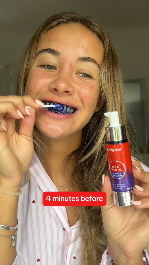 Before vs after!

*Instant effect is temporary

**by removing surface stains with twice daily brushing. Individual results may vary.

#Colgate
