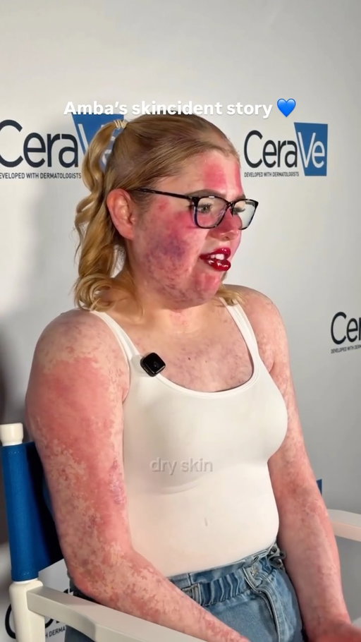 episode three of skincident confessionals with @_amba_smith_ ✨

a fan of our intensive moisturising lotion since 2019 to help with the dryness from her birthmark 💙 #cerave #skincident