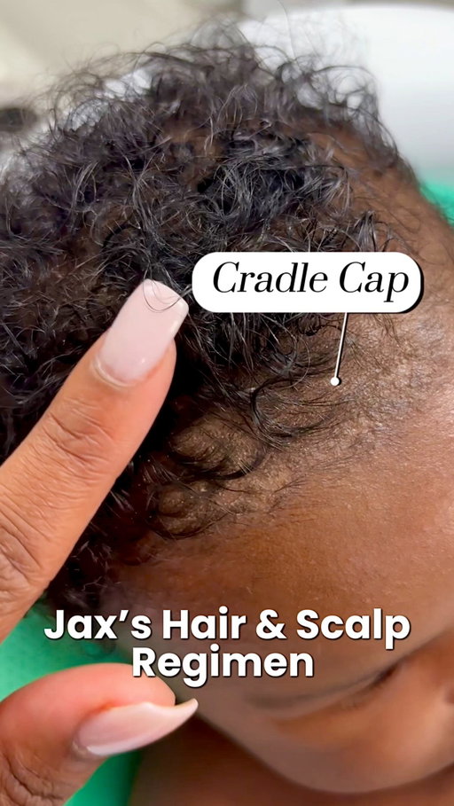 Cradle cap is super common and all three of my babies have had it so it’s nothing I worry about. I like to keep a simple and easy hair/scalp routine to help treat and get rid of it with minimal hair loss during the process! Did your little one have cradle cap?

@happycappyshampoo 
@babydovecare 
@freeyourcurls 

#cradlecap #babyhaircare #newbornmusthaves #parentsupport #parenttips #newborntips #momtips #postpartumsupport