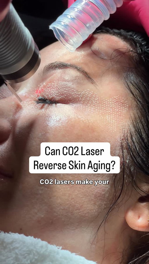 Curious about CO2 laser resurfacing? Board-certified dermatologist Dr. Julie de la Cruz (@skinandsweat) is back on @glowlabpodcast to explain everything you need to know.

Watch/listen to the full episode wherever you get podcasts OR COMMENT “LASER” to have the link sent to your DMs. Link in bio/stories too!

#glowlabpodcast #glowlabwithsusanyara #co2 #co2laser