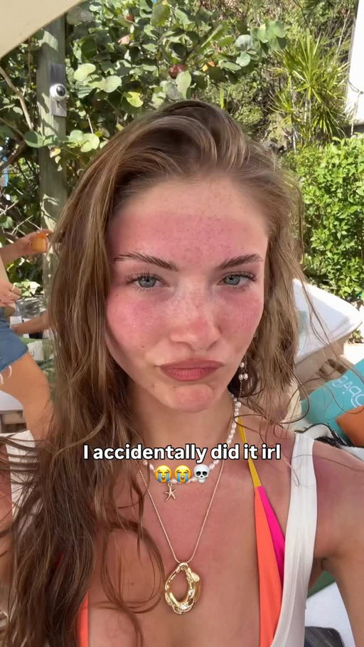like actually what do I do LMAO 😀
#relatable #trending #funny #sunburn