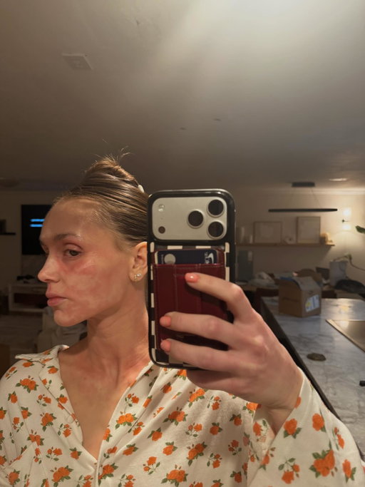 Chronically over this shit 🥰 oh and still chronically ill🫡