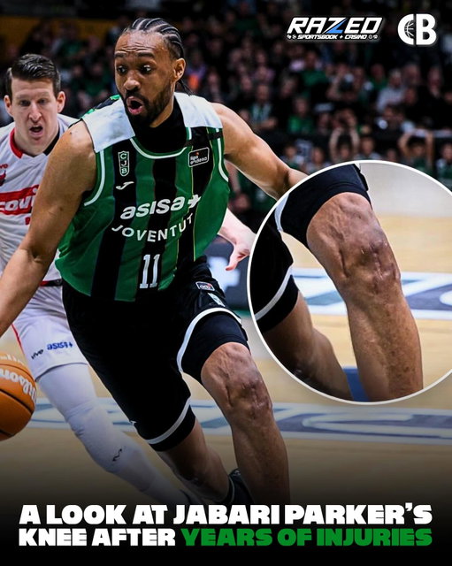 A look at Jabari Parker’s knee in 2026 after years of injuries 😳

Parker, 30, plays for Joventut Badalona in the Spanish Liga ACB & the FIBA Champions League. 

December 15, 2014: Torn ACL in the left knee (non-contact injury vs. Phoenix Suns), which ended his rookie season after 25 games.
February 8, 2017: Torn ACL in the same left knee (non-contact injury vs. Miami Heat), which ended his 2016-17 season. 

Both injuries required surgical repair & roughly 12-month recovery periods.