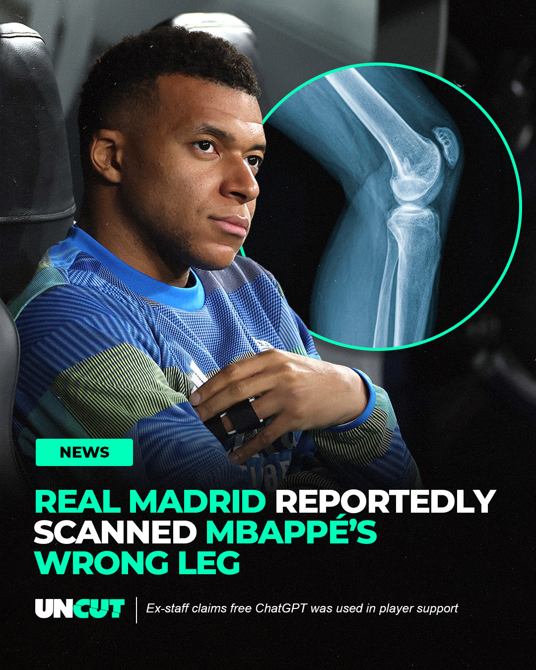 Real Madrid reportedly scanned the wrong leg for Mbappé 😳⁠
⁠
The mistake led to a misdiagnosis before they finally found a ligament tear on the correct knee 👀⁠
⁠
Y’all trusting that medical team or nah⁉️👀