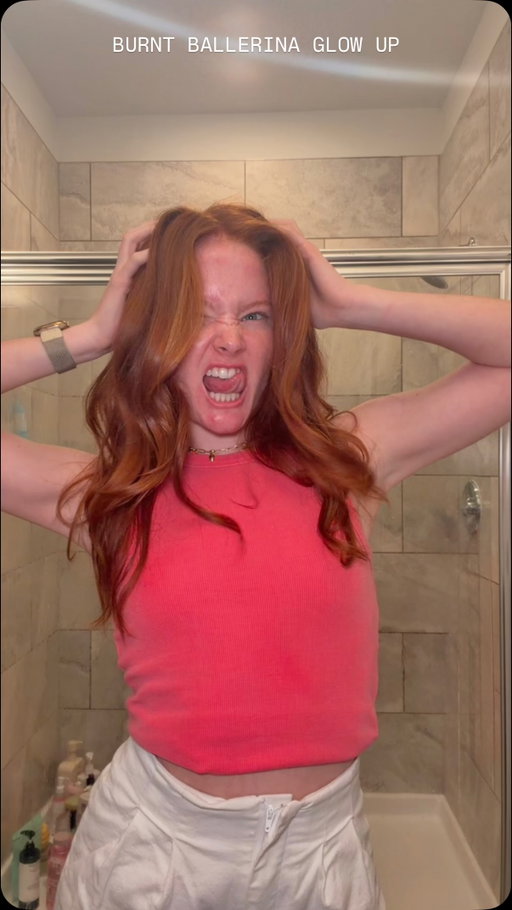 sunburn tips appreciated ☀️🫧 #sunburn #beach #ballet #grwm #showerroutine @olaplex @somebymi.official_us @oseamalibu @beplain_global @bloomeffects @haruharuwonder_official @cosrx @lorealparis @foxybaehair @rarebeauty