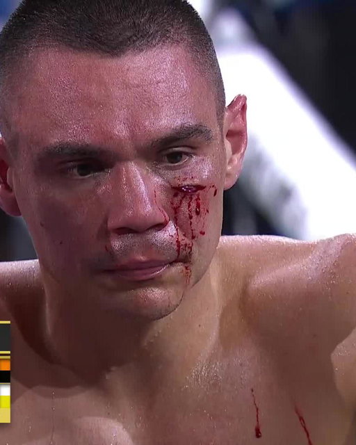 Deja vu for @TimTszyu as a clash of heads leads to deep cut on the cheek of Tszyu. 

📺 Watch #TszyuNurja live on @PrimeVideo: https://pbcham.ps/TszyuNurja