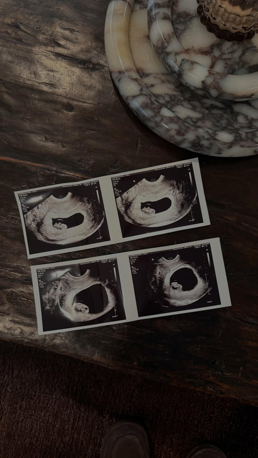 “Hey I’m pregnant” - how i announced to my loved ones 🤍 
Family of four coming this Fall 😭🙏🏼🥰🤰thanks @torvo_