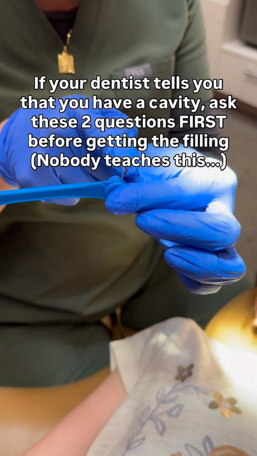 Most people are rushed into fillings for what’s actually called an incipient lesion—the earliest stage of decay.

That’s not a full-blown cavity. It’s a warning sign—and often, it’s reversible.

The 2 questions to ask:

1) Is this an incipient lesion?

2) Can we try remineralization first before drilling? Fygg varnish is excellent for this.

If it’s not cavitated, and there’s still enough enamel, you may not need a filling at all.

Modern dentistry isn’t just “drill, fill, and bill.”

It’s about preserving your natural tooth structure and working with your body-not against it.

And here’s the secret:

The best filling is the one you never need.

Send this to a friend who should hear this before their next dental visit and follow @askthedentist for more tips like this

Comment “REVERSAL” for my free guide to learn more